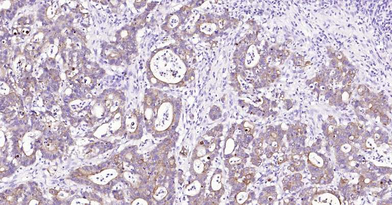 人细胞角蛋白18即用型免疫组化试剂盒-IHC0249H